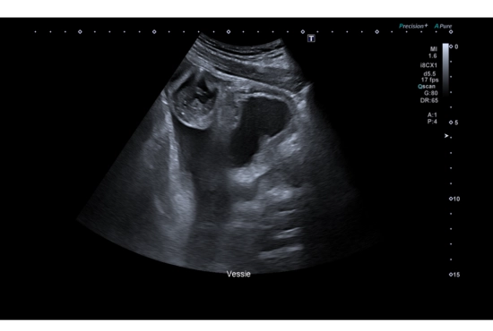 Découverte fortuite